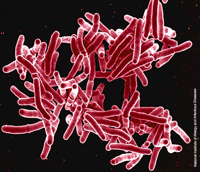 Mycobacterium tuberculosis bacteria